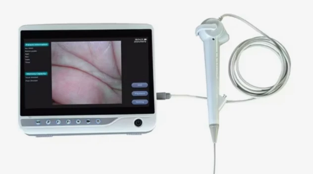 equine endoscopy equipment equine endoscopy equipment